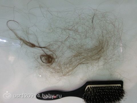 Выпадение волос при мытье. Норма выпадения волос. Норм норма выпадения волос. Норма выпадения волос в день у женщин. Норма выпадения волос наглядно.